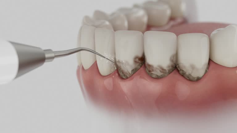 Trusted Dental Crowns And Bridges service in Rosenhayn, NJ - Dentist Open Now
